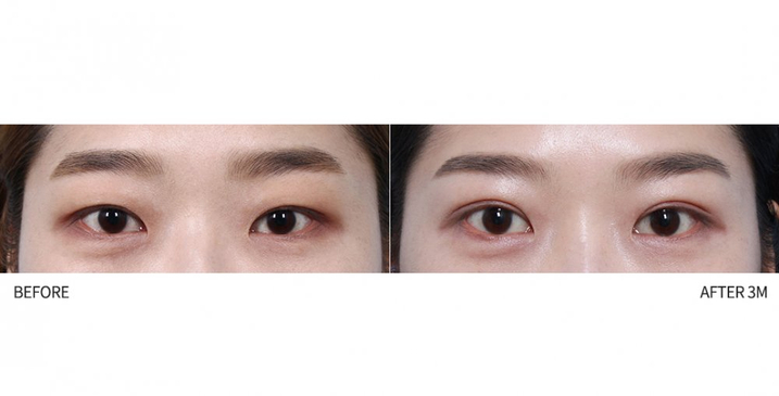 Slider image (4) 1mm Plastic Surgery